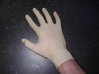 Latex allergy